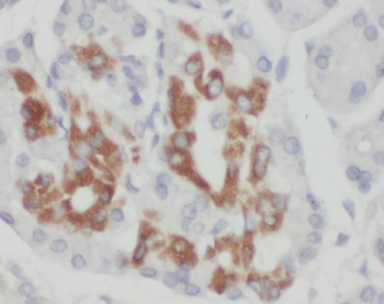 ZNF2 Rabbit Polyclonal Antibody