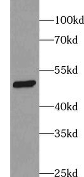 ZBTB18 Rabbit Polyclonal Antibody