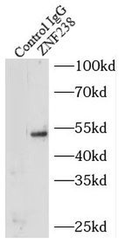 ZBTB18 Rabbit Polyclonal Antibody