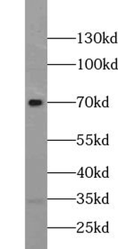 ZNF251 Rabbit Polyclonal Antibody