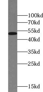ZPR1 Rabbit Polyclonal Antibody