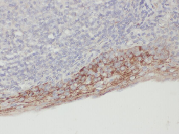 ZPR1 Rabbit Polyclonal Antibody