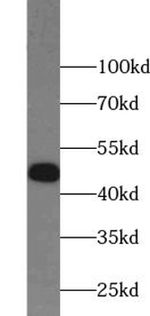 Znf271 Rabbit Polyclonal Antibody