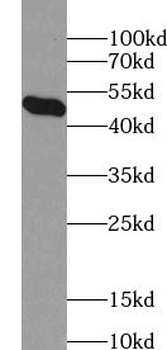 ZNF3 Rabbit Polyclonal Antibody