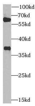 ZNF346 Rabbit Polyclonal Antibody