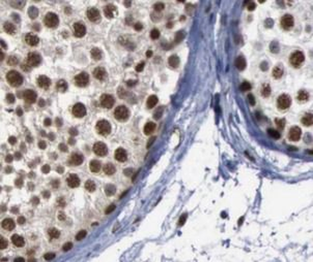 ZNF346 Rabbit Polyclonal Antibody