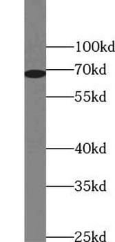 ZNF354A Rabbit Polyclonal Antibody