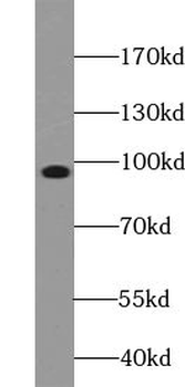ZNF366 Rabbit Polyclonal Antibody