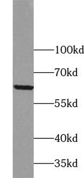 ZNF395 Rabbit Polyclonal Antibody