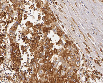 ZNF622 Rabbit Polyclonal Antibody