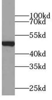 ZRANB2 Rabbit Polyclonal Antibody