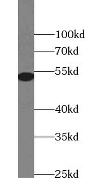 ZSCAN21 Rabbit Polyclonal Antibody