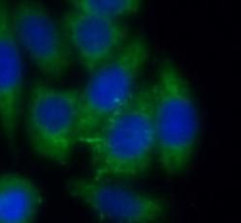 ZYX Mouse Monoclonal Antibody