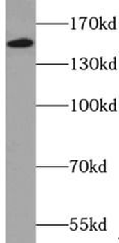 ZZZ3 Rabbit Polyclonal Antibody