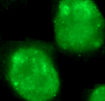 MKI67 Antibody
