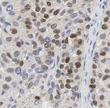 MKI67 Antibody