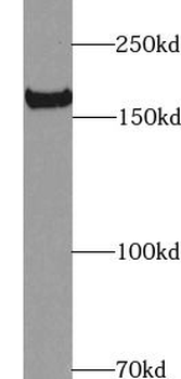 KDR Rabbit Polyclonal Antibody
