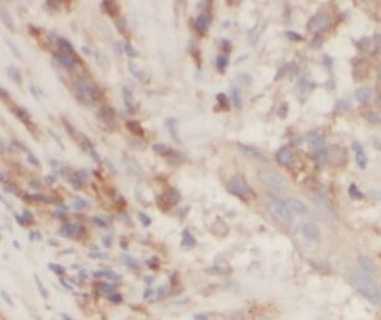 KDR Rabbit Polyclonal Antibody