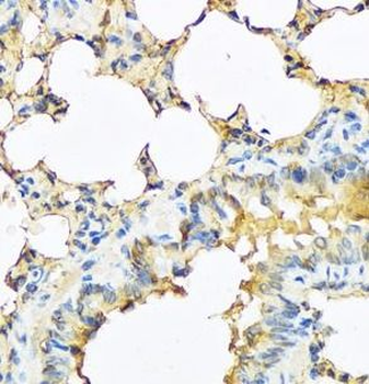 TSHB Rabbit Polyclonal Antibody