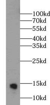 PVALB Rabbit Polyclonal Antibody