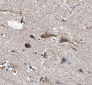 PVALB Rabbit Polyclonal Antibody