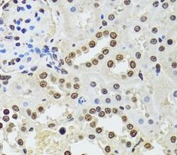 CDX2 Rabbit Polyclonal Antibody