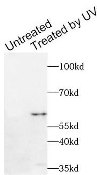Phospho CHEK1 (S280) Rabbit Polyclonal Antibody
