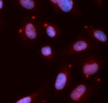 Phospho CHEK1 (S280) Rabbit Polyclonal Antibody