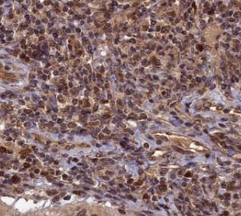 TOP1 Rabbit Polyclonal Antibody