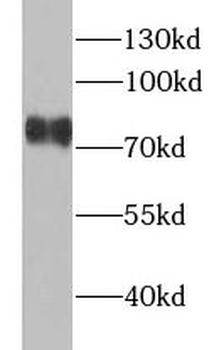 YAP1 Rabbit Polyclonal Antibody