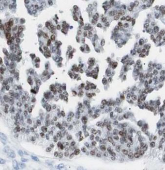 YAP1 Rabbit Polyclonal Antibody