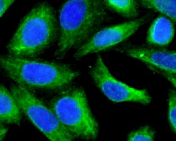 P4HB Mouse Monoclonal Antibody