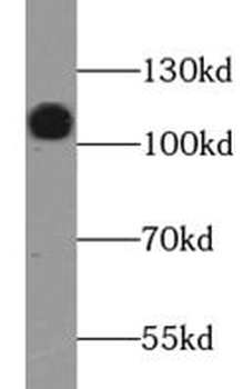 LAMP2 Mouse Monoclonal Antibody