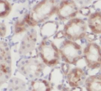 LAMP2 Mouse Monoclonal Antibody