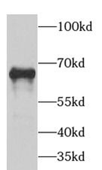 GAD1 Rabbit Polyclonal Antibody