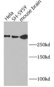 HTT Rabbit Polyclonal Antibody