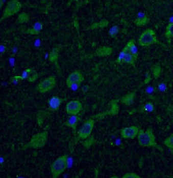 HTT Rabbit Polyclonal Antibody