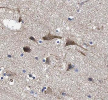 HTT Rabbit Polyclonal Antibody