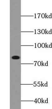 Phospho BTK (Tyr223) Rabbit Polyclonal Antibody
