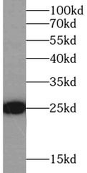 GSTP1 Rabbit Polyclonal Antibody