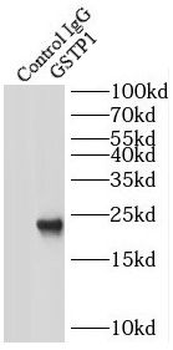 GSTP1 Rabbit Polyclonal Antibody
