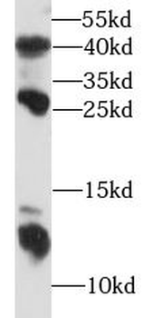 S100A8 Antibody
