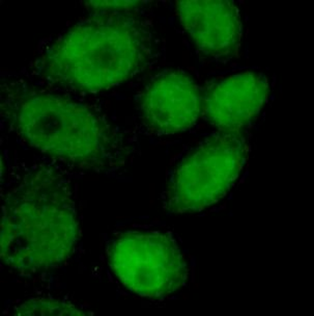 NF1 Rabbit Polyclonal Antibody