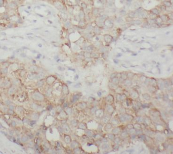 NF1 Rabbit Polyclonal Antibody