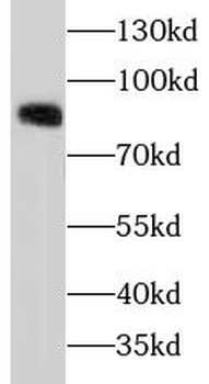 CTNNB1 Mouse Monoclonal Antibody