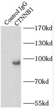 CTNNB1 Mouse Monoclonal Antibody