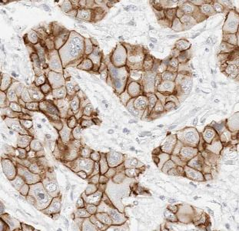 CTNNB1 Mouse Monoclonal Antibody