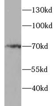 RELA Rabbit Polyclonal Antibody