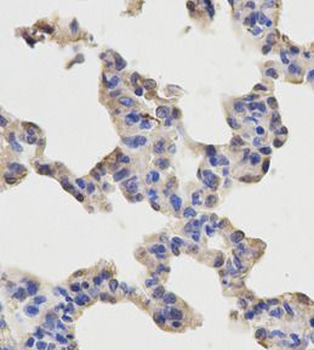 RELA Rabbit Polyclonal Antibody