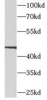 CALCRL Antibody